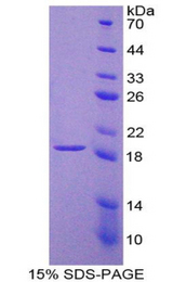 LAMB2 / Laminin Beta 2 Protein - Recombinant Laminin Beta 2 By SDS-PAGE