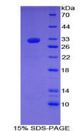 LAMC1 / Laminin Gamma 1 Protein - Recombinant Laminin Gamma 1 By SDS-PAGE
