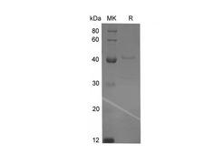 LAMP3 / CD208 Protein - Recombinant Rat LAMP3/CD208/DC-LAMP Protein (His Tag)-Elabscience