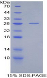 Latexin / MUM Protein - Recombinant Latexin By SDS-PAGE