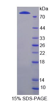 LBP Protein - Recombinant  Lipopolysaccharide Binding Protein By SDS-PAGE