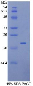 LCN2 / Lipocalin 2 / NGAL Protein - Recombinant Neutrophil Gelatinase Associated Lipocalin By SDS-PAGE