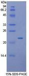 LCN2 / Lipocalin 2 / NGAL Protein - Recombinant Neutrophil Gelatinase Associated Lipocalin By SDS-PAGE