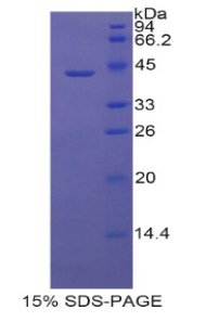 LCN6 Protein - Recombinant Lipocalin 6 By SDS-PAGE