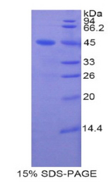 LCN8 Protein - Recombinant Lipocalin 8 By SDS-PAGE