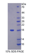LCNL1 Protein - Recombinant Lipocalin Like Protein 1 By SDS-PAGE