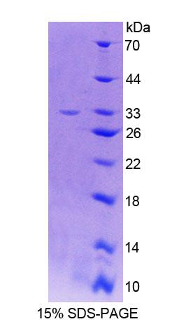 LCT / Lactase Protein - Recombinant  Lactase By SDS-PAGE