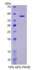 LDHC / Lactate Dehydrogenase C Protein - Recombinant  Lactate Dehydrogenase C By SDS-PAGE