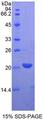 LECT2 Protein - Recombinant Leukocyte Cell Derived Chemotaxin 2 By SDS-PAGE