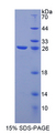 LGALS12 / Galectin 12 Protein - Recombinant  Galectin 12 By SDS-PAGE