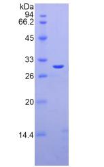 LGALS3 / Galectin 3 Protein - Recombinant Galectin 3 By SDS-PAGE