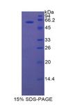 LIPC / Hepatic Lipase Protein - Recombinant Lipase, Hepatic By SDS-PAGE