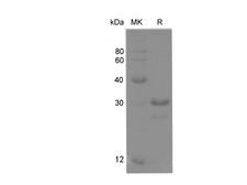 LMNB1 / Lamin B1 Protein - Recombinant Rat Lamin B1 Protein (His Tag)-Elabscience