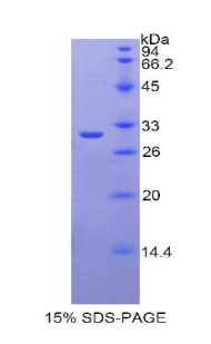 LPO / Lactoperoxidase Protein - Recombinant Lactoperoxidase By SDS-PAGE
