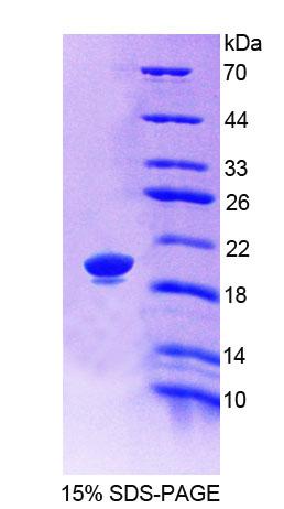 LRP11 Protein - Recombinant Low Density Lipoprotein Receptor Related Protein 11 (LRP11) by SDS-PAGE