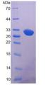 LRP5 Protein - Recombinant Low Density LiPoprotein Receptor Related Protein 5 By SDS-PAGE