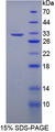 LRRC32 Protein - Recombinant  Leucine Rich Repeat Containing Protein 32 By SDS-PAGE