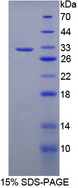 LRRC32 Protein - Recombinant  Leucine Rich Repeat Containing Protein 32 By SDS-PAGE