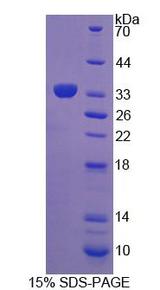LSP1 Protein - Recombinant Lymphocyte Specific Protein 1 By SDS-PAGE