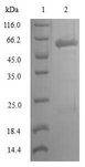 Lumican Protein - (Tris-Glycine gel) Discontinuous SDS-PAGE (reduced) with 5% enrichment gel and 15% separation gel.