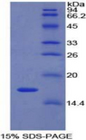 LYAR Protein - Recombinant Ly1 Antibody Reactive Homolog By SDS-PAGE