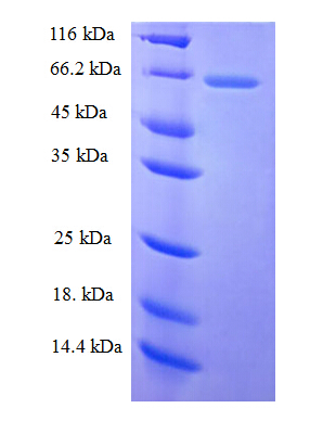 MAC-2-BP / LGALS3BP Protein