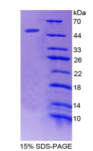 MAGP / MFAP2 Protein - Recombinant Microfibrillar Associated Protein 2 By SDS-PAGE