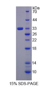 MAP3K6 / MEKK6 Protein - Recombinant  Mitogen Activated Protein Kinase Kinase Kinase 6 By SDS-PAGE