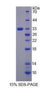 MAP3K6 / MEKK6 Protein - Recombinant  Mitogen Activated Protein Kinase Kinase Kinase 6 By SDS-PAGE