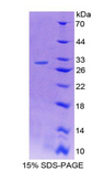 MAP4 Protein - Recombinant  Microtubule Associated Protein 4 By SDS-PAGE
