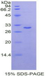 MAPK8 / JNK1 Protein - Recombinant Mitogen Activated Protein Kinase 8 By SDS-PAGE
