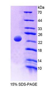 MATK Protein - Recombinant Megakaryocyte Associated Tyrosine Kinase By SDS-PAGE