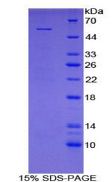 MBL2 / Mannose Binding Protein Protein - Recombinant Mannose Binding Lectin By SDS-PAGE