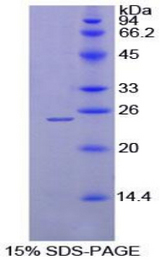 MEPE Protein - Recombinant Matrix Extracellular Phosphoglycoprotein By SDS-PAGE