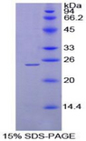 MEPE Protein - Recombinant Matrix Extracellular Phosphoglycoprotein By SDS-PAGE