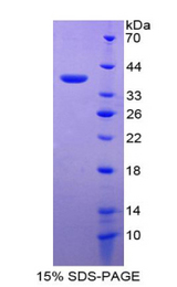 Metallothionein 2 Protein - Recombinant Metallothionein 2 By SDS-PAGE