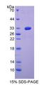 METRN / Meteorin Protein - Recombinant  Meteorin By SDS-PAGE