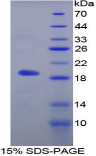 MFAP5 / MAGP2 Protein - Recombinant Microfibrillar Associated Protein 5 By SDS-PAGE
