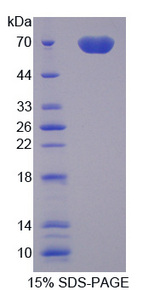 MFGE8 /Lactadherin Protein - Recombinant Milk Fat Globule EGF Factor 8 By SDS-PAGE