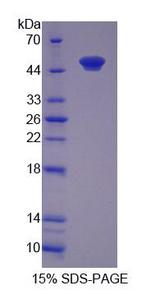 MGMT Protein - Recombinant O-6-Methylguanine DNA Methyltransferase By SDS-PAGE