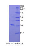 MGST1 Protein - Recombinant Microsomal Glutathione S Transferase 1 (MGST1) by SDS-PAGE