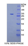 MIB2 Protein - Recombinant Mindbomb Homolog 2 By SDS-PAGE