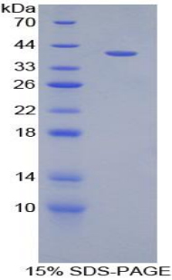 MIP2 / GRO2 / CXCL2 Protein - Recombinant Growth Regulated Oncogene Beta By SDS-PAGE