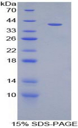 MIP2 / GRO2 / CXCL2 Protein - Recombinant Growth Regulated Oncogene Beta By SDS-PAGE