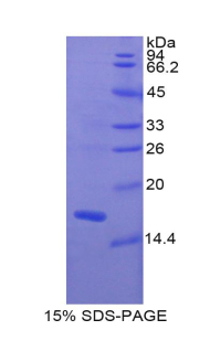 MLC3F / MYL1 Protein - Recombinant Myosin Light Chain 1, Alkali, Fast Skeletal By SDS-PAGE