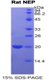 MME / CD10 Protein - Recombinant Neprilysin By SDS-PAGE