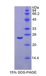 MMP11 Protein - Recombinant Matrix Metalloproteinase 11 By SDS-PAGE