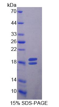MMP13 Protein - Recombinant Matrix Metalloproteinase 13 By SDS-PAGE