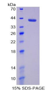 MMP23 Protein - Recombinant Matrix Metalloproteinase 23A By SDS-PAGE