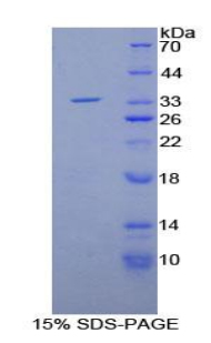 MMP7 / Matrilysin Protein - Recombinant Matrix Metalloproteinase 7 By SDS-PAGE